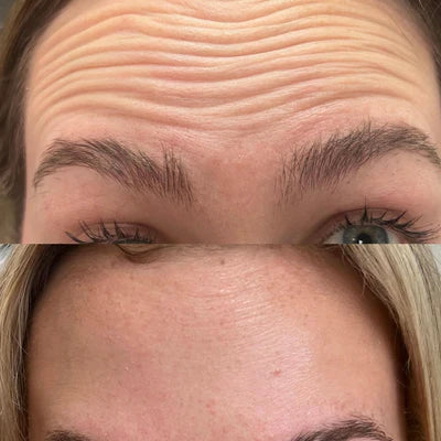 GlowLift™ Sculpteur visage et cou